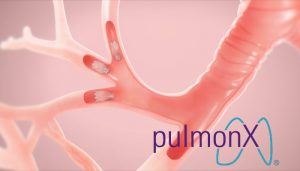 Pulmonx