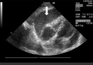 Cardiac Ultrasounds