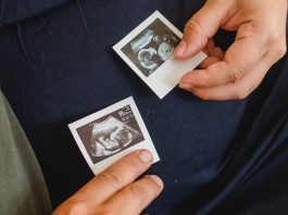 Sonio’s AI-Powered Quality Control Software Revolutionizes Medical Imaging in Prenatal Care