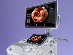 GE HealthCare's AI Ultrasound Systems