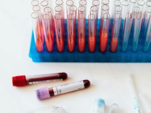 Blood Purification Innovations