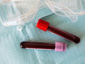 Guardant's Colorectal Cancer Test