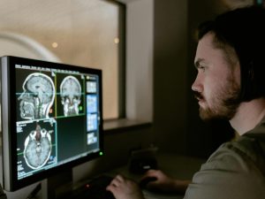 AI Tool Revolutionizes Alzheimer's Detection
