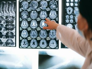 GE HealthCare Boosts AI Imaging