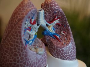 Viz.ai Enhances Lung Disease Detection