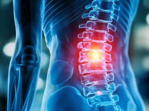Stryker Selling Spinal Businesses in the U.S.