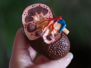 Dimerix and Amicus Kidney Drug Deal