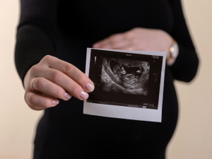 Carrot Launches Sprints Program